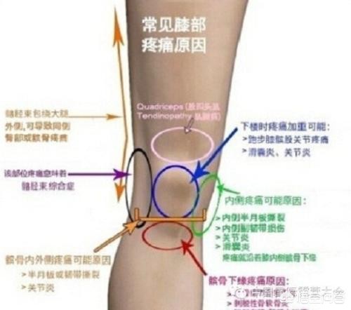 练体育膝盖疼怎么治_练体育膝盖疼怎么治疗
